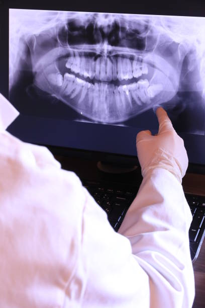 Best Emergency Dentist for Lost Fillings or Crowns in Sunrise Beach Village, TX